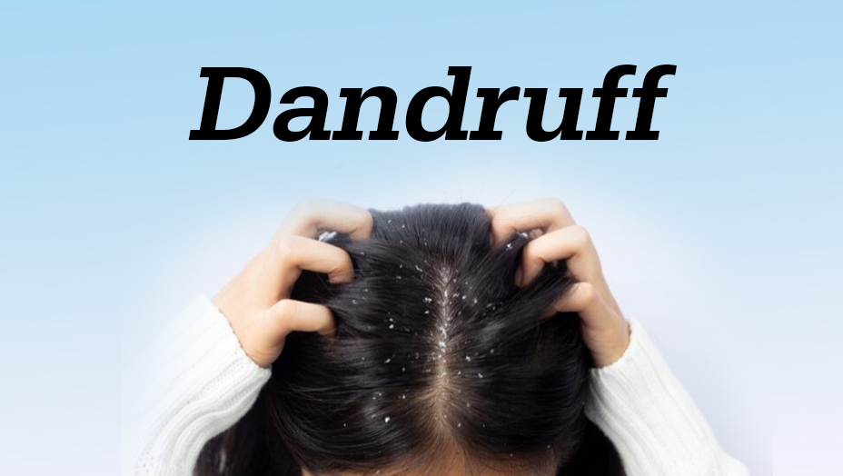 Hair Problem #1