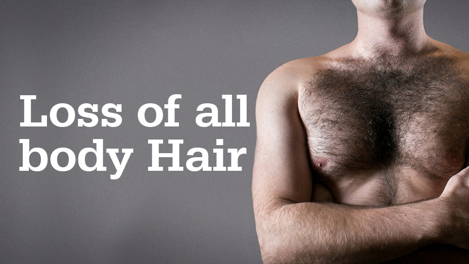 Hair Problem #1