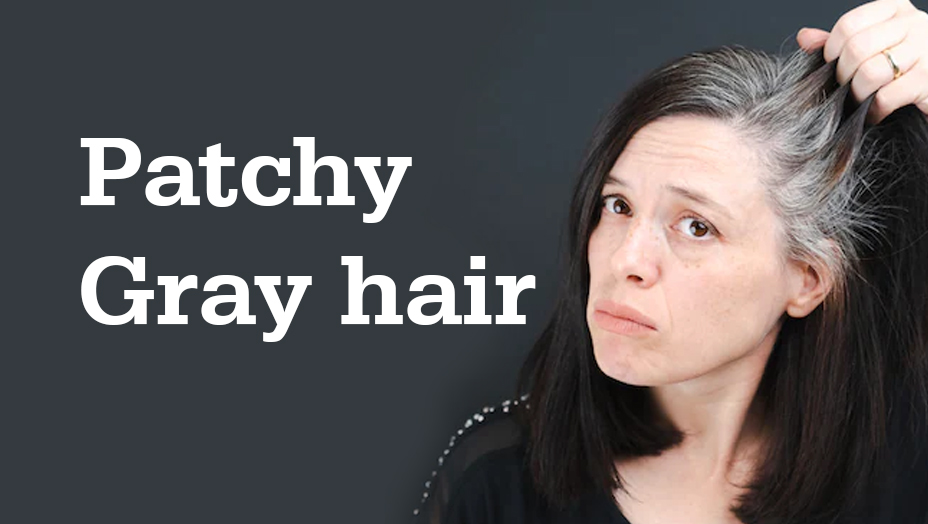 Hair Problem #1